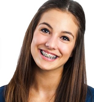 Braces